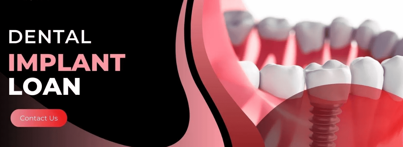 Dental Implant Loans